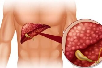 liver swollen hepatomegaly symptoms and causes of an enlarged liver लिवर में है सूजन तो पेट पर कौन से लक्षण दिखाई देने लगते हैं? हेल्थ एक्सपर्ट से जानें